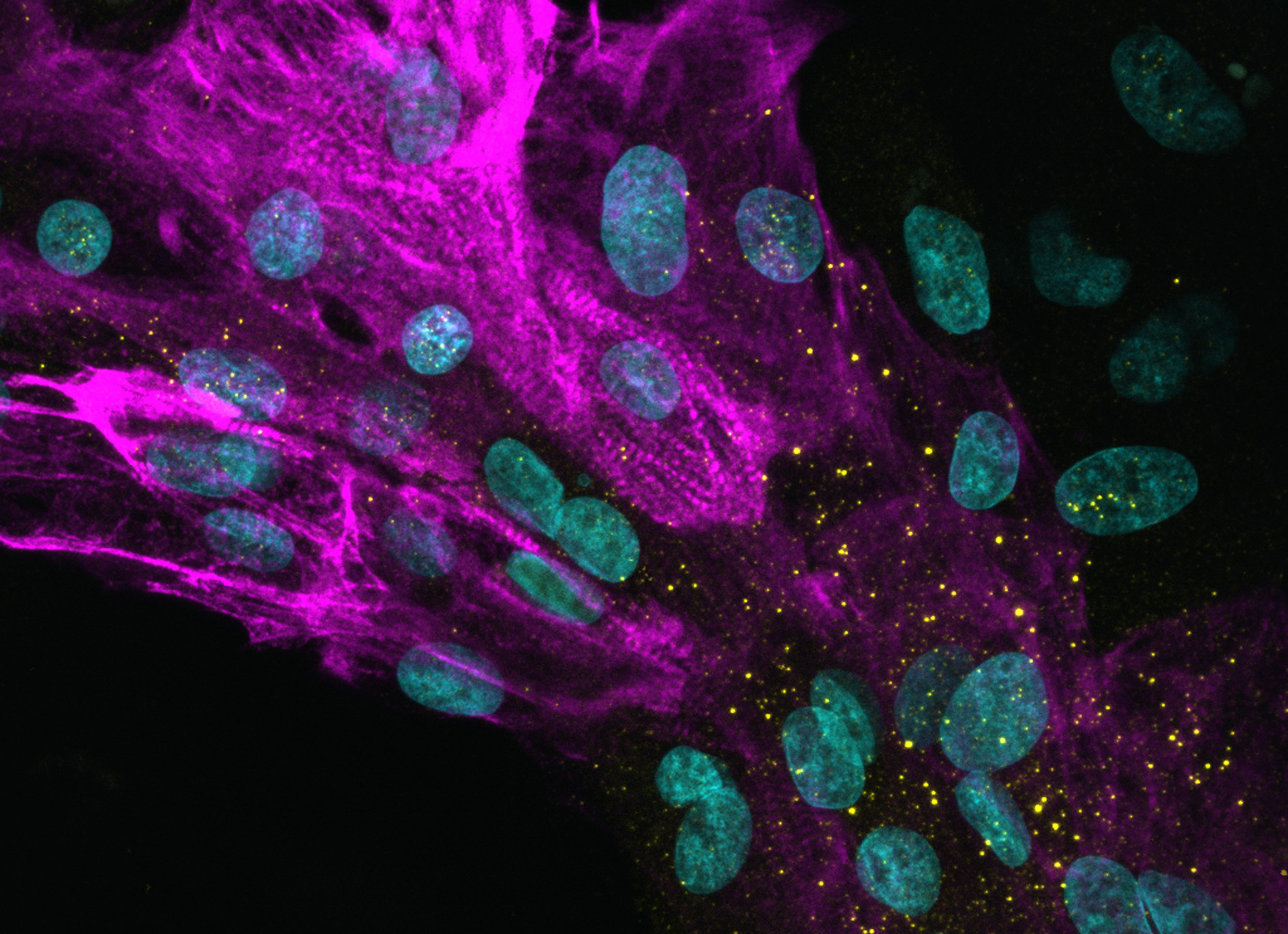 Heart muscle cells infected with Omicron