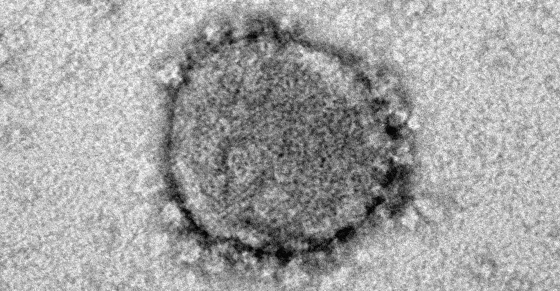 Stimmungsbild Corona Virus unter Mikroskop
