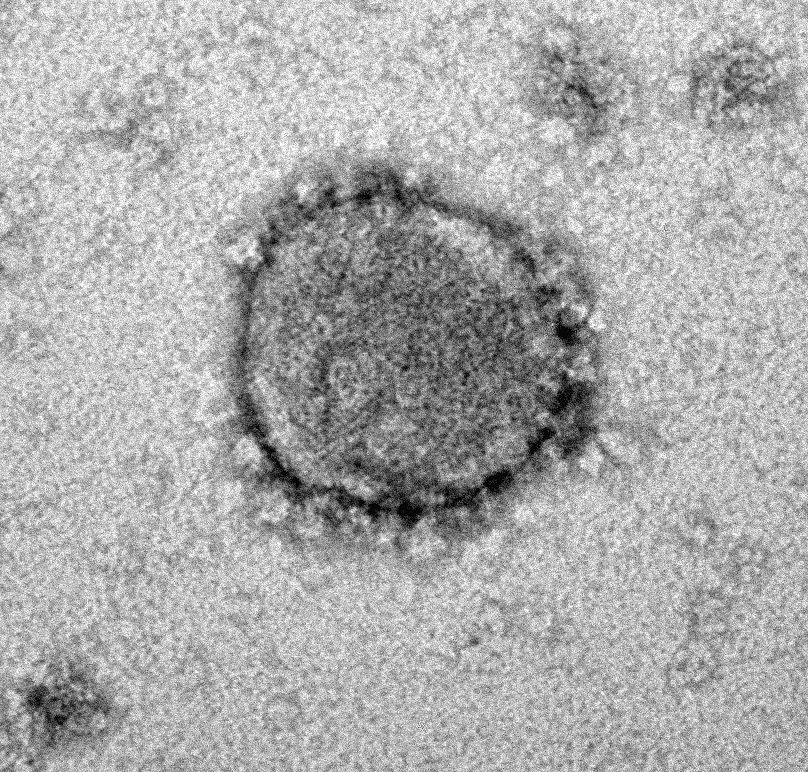 Electron microscope image of  coronavirus SARS-CoV-2 