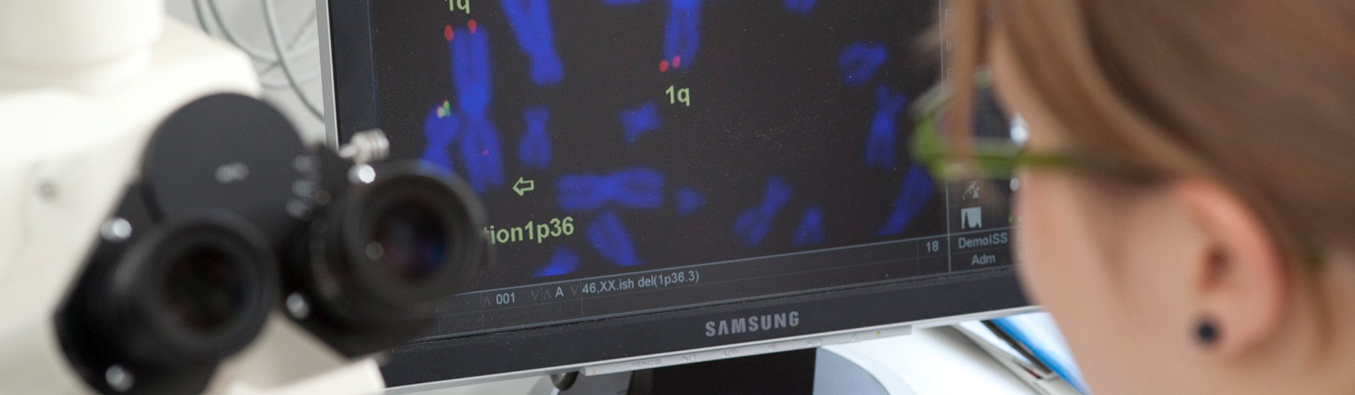 Forscherin betrachtet unter dem Mikroskop genetische Strukturen auf einem Bildschirm – Visualisierung von Chromosomen mit Markierungen zur Forschung an der Universität Ulm.
