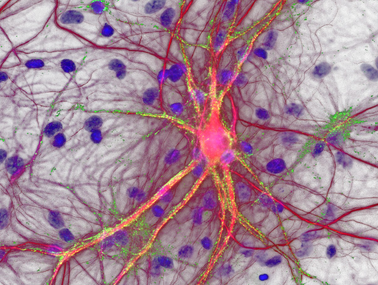 Motoneurone: Bei der Amyotrophen Lateralsklerose gehen diese Nervenzellen zugrunde (Abbildung: RKU)