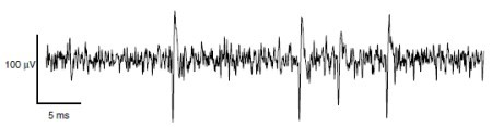 [Translate to english:] Figure 1 - Example of a neural signal