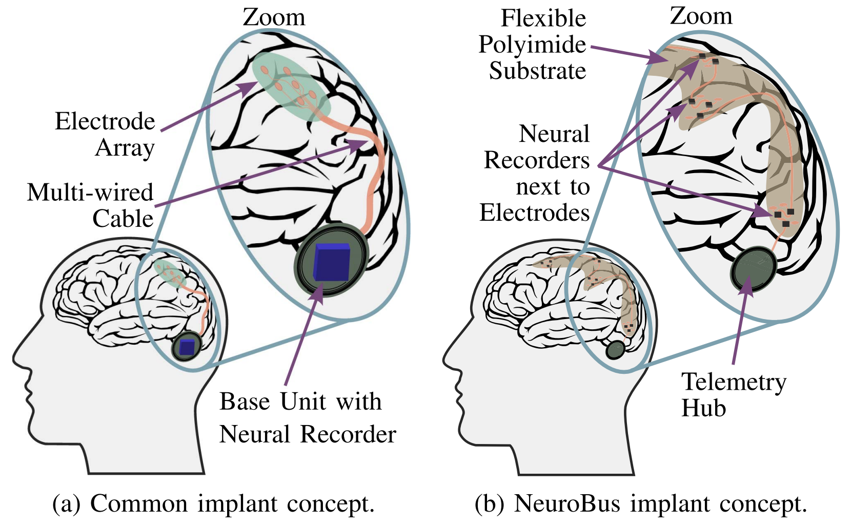 NeuroBus-Implantatkonzept NeuroBus-Implantatkonzept