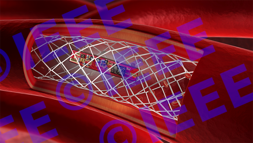Conceptual architecture of an active stent Conceptual architecture of an active stent