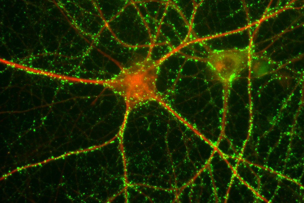 Lokalisation von phospho-HspB5(Ser45) in Dendriten von kultivierten hippocampalen Neuronen. Rot: HspB5; grün: vGlut-1 (Marker für Synapsen)