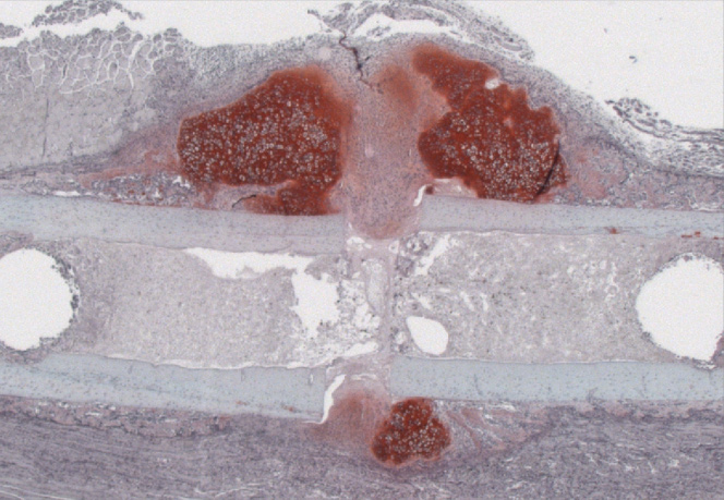 Mikroskop-Bild eines histologischen Schnittes eines Frakturkallus
