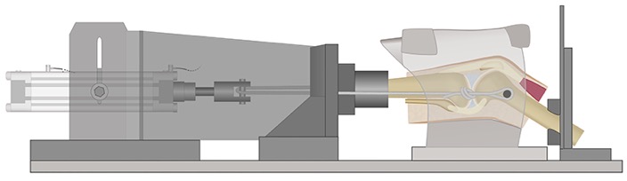 Selbst entwickelte und gebaute Vorrichtung um belastete Kniegelenke im Magnetresonanztomographen zu scannen