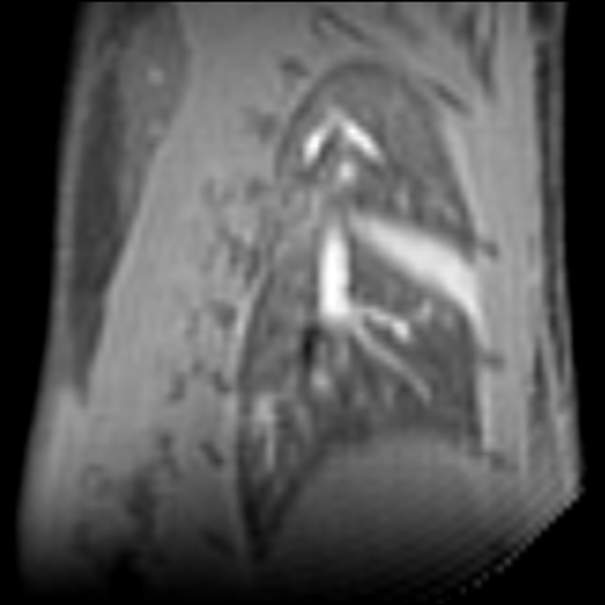 Sagittal view Sagittal view of lung imaging