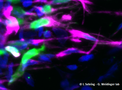 Ganzpräparat einer transgenen Flosse, in der eine Teilpopulation der Osteoblasten GFP exprimiert (grün).