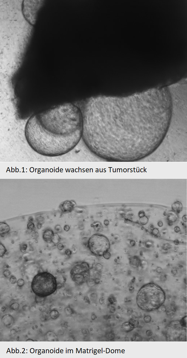 Die Etablierung von Organoid-Kulturen