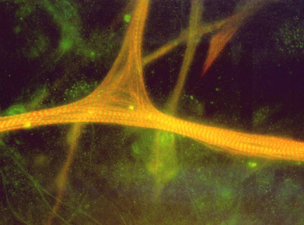 Das abgebildete Muskelbündel wurde für eine funktionelle Untersuchung präpariert. Die Muskelfasern zeigen die charakteristische Querstreifung. Das abgebildete Muskelbündel wurde für eine funktionelle Untersuchung präpariert. Die Muskelfasern zeigen die charakteristische Querstreifung.
