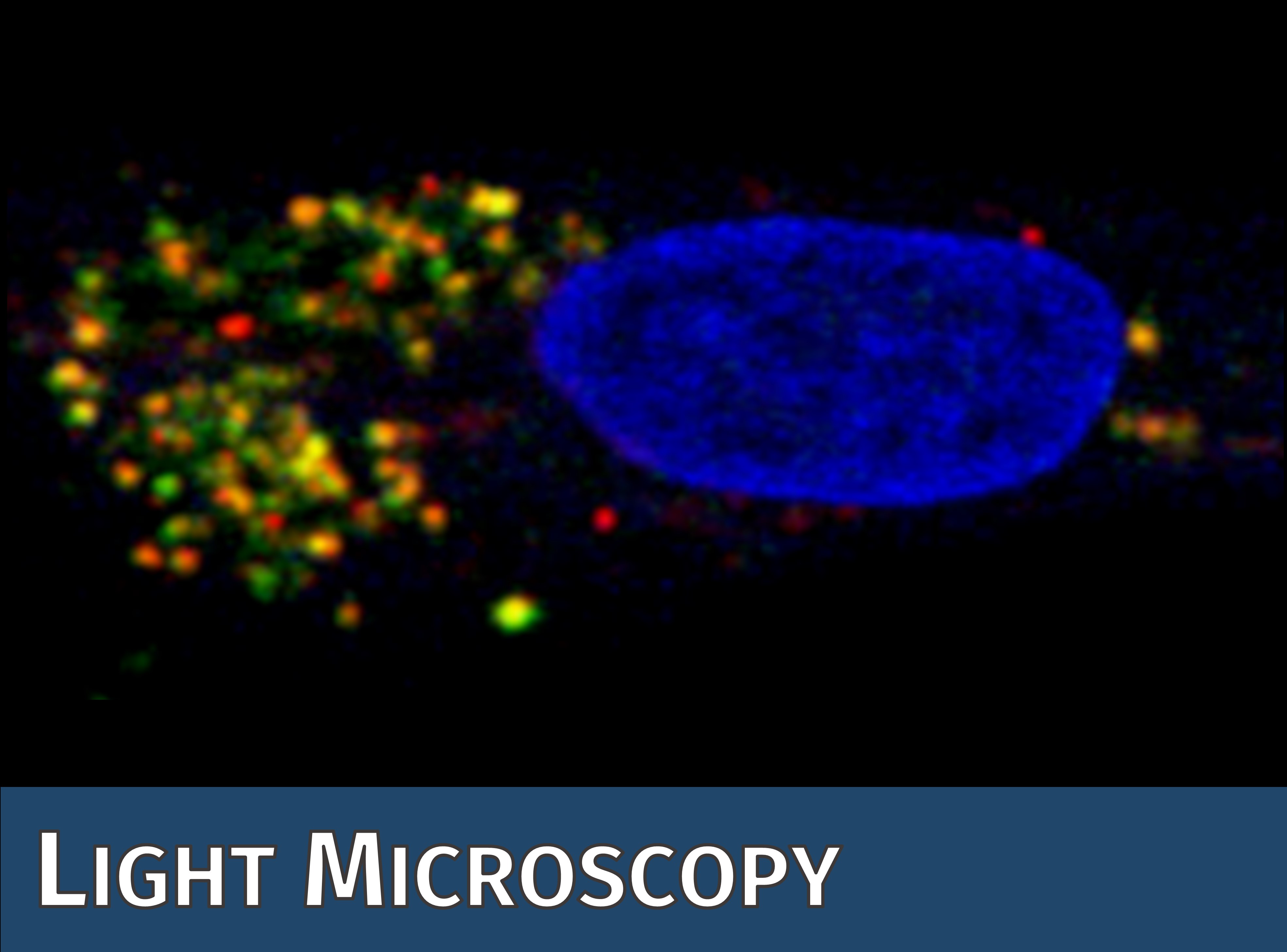 Symbolbild der CF Lichtikroskopie: Mikroskopaufnahme von fluoreszierenden Zellen