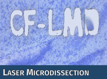 Das Symbolbild der CF Lasermicrodissection zeigt als Anwendungsbeispiel Zellen, bei denen der Name der CF als Schriftzug ausgeschnitten wurde.