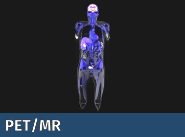 Das Symbolbild der CF PET/MR zeigt ein beispielhaftes Kombinationsbild eines humanen Ganzkörper Scans mittels MR und PET.