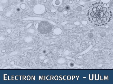 Das Symbolbild der Zentralen Einrichtung Elektronenmikroskopie der Universität Ulm zeigt eine Zellaufnahme mittels Transmissionselektronenmikroskopie.