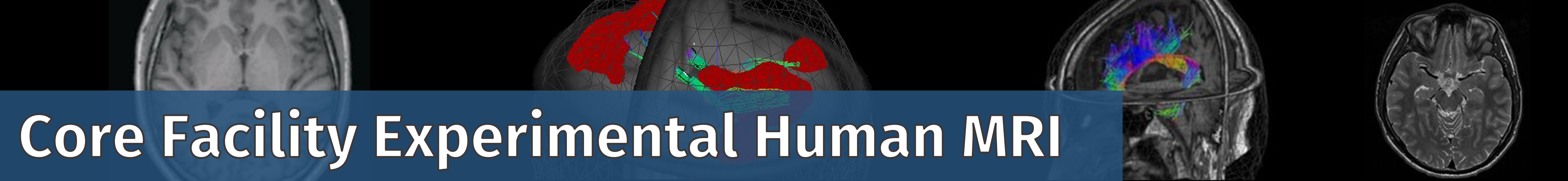 Bannertitel der CF Experimental Human MRI