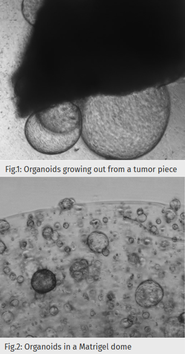 The figure shows an example of the establishment of organoid cultures.