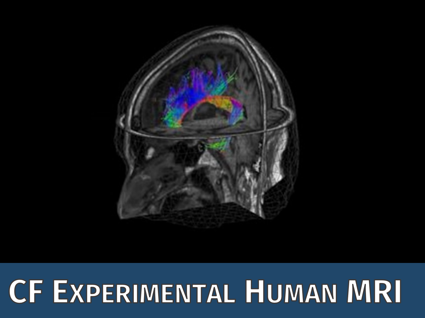 CF Experimental Human MRI