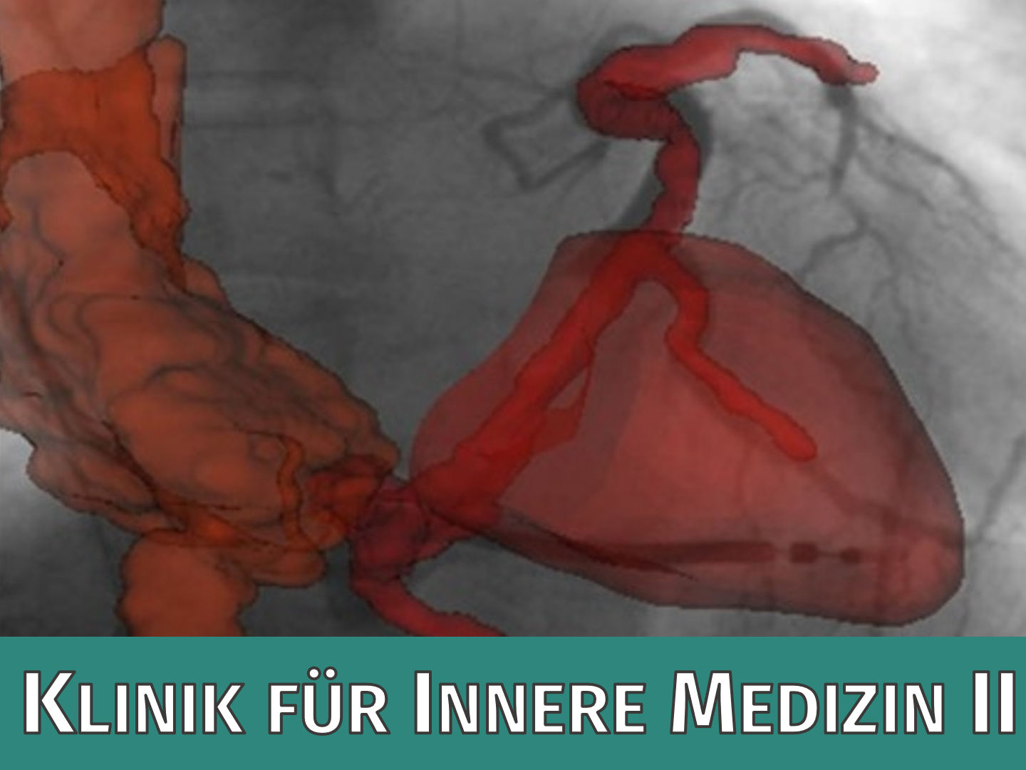 Klinik für Innere Medizin II