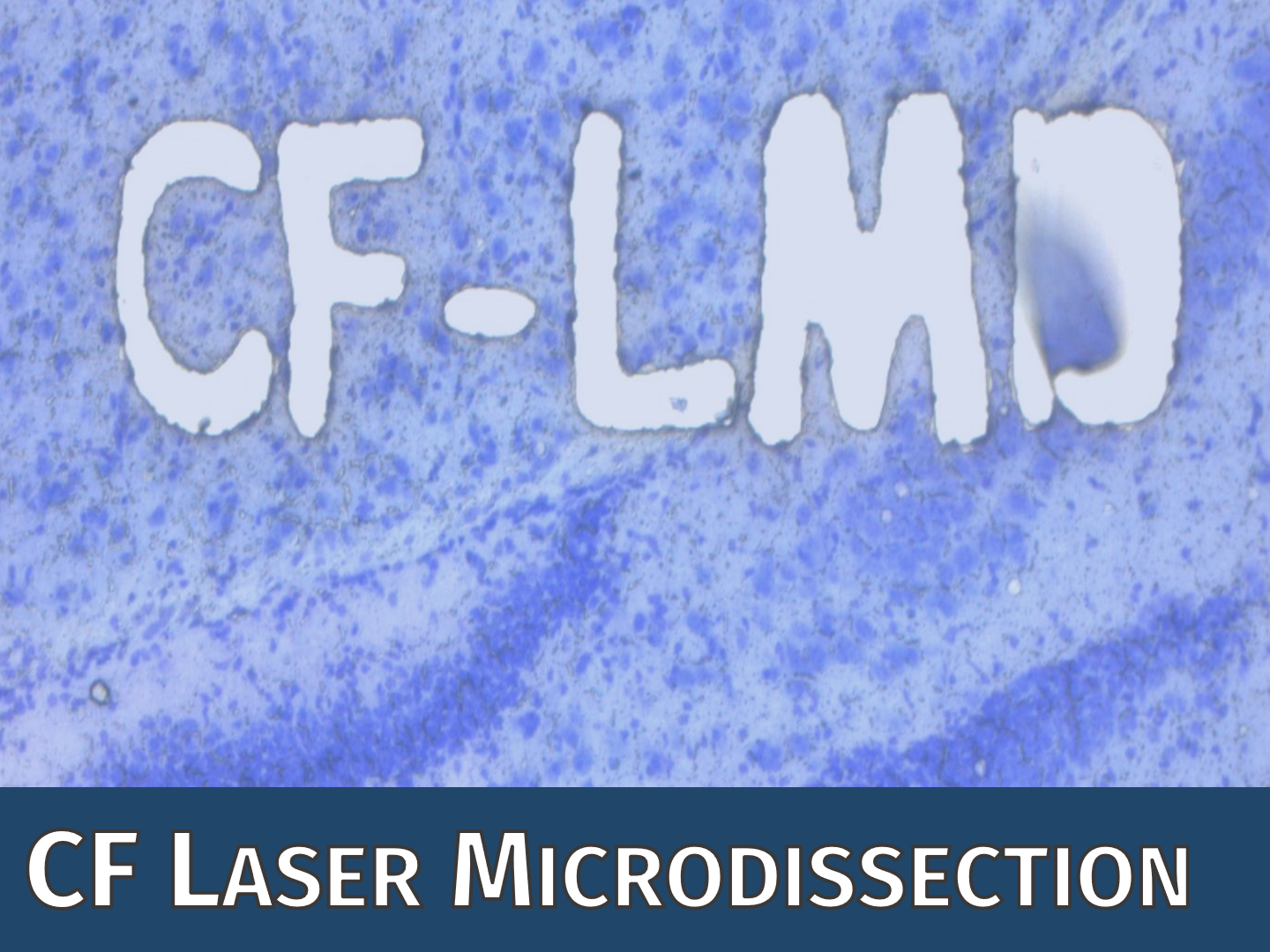 CF Laser Mircrodissection