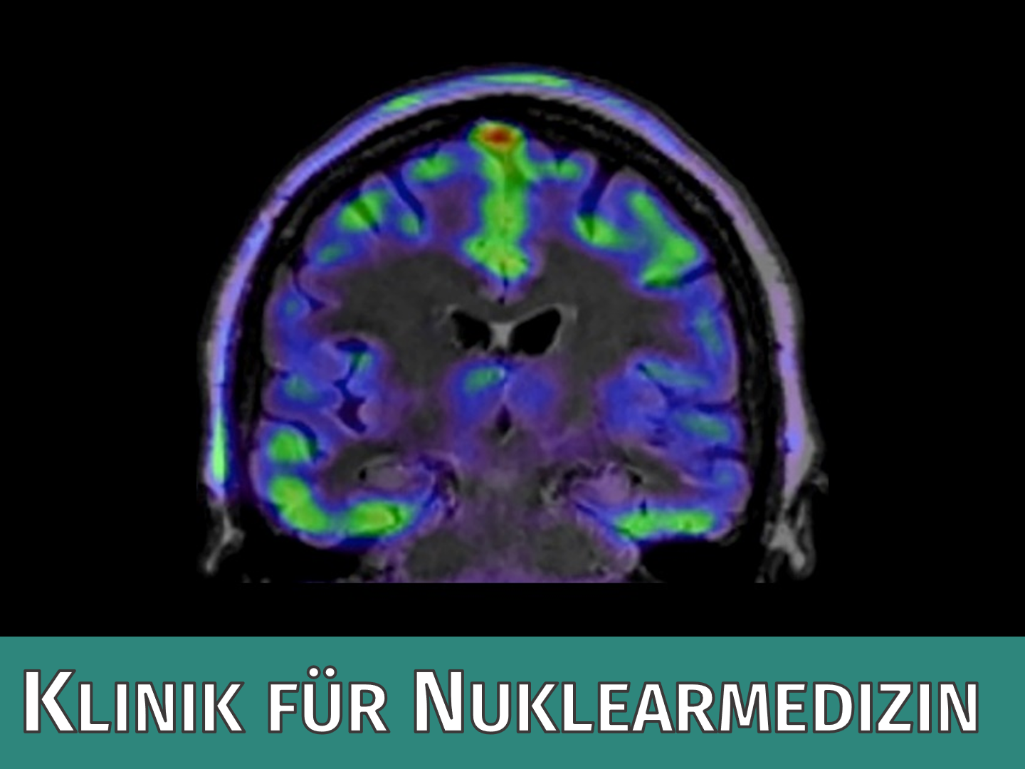 Klinik für Nuklearmedizin