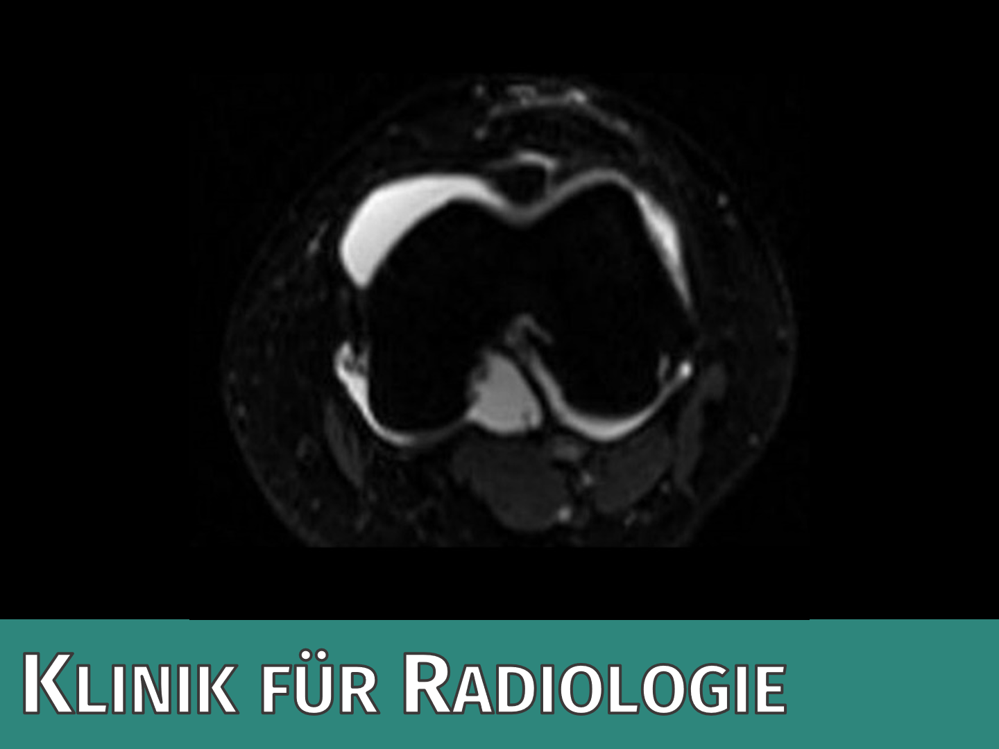 Klinik für Radiologie