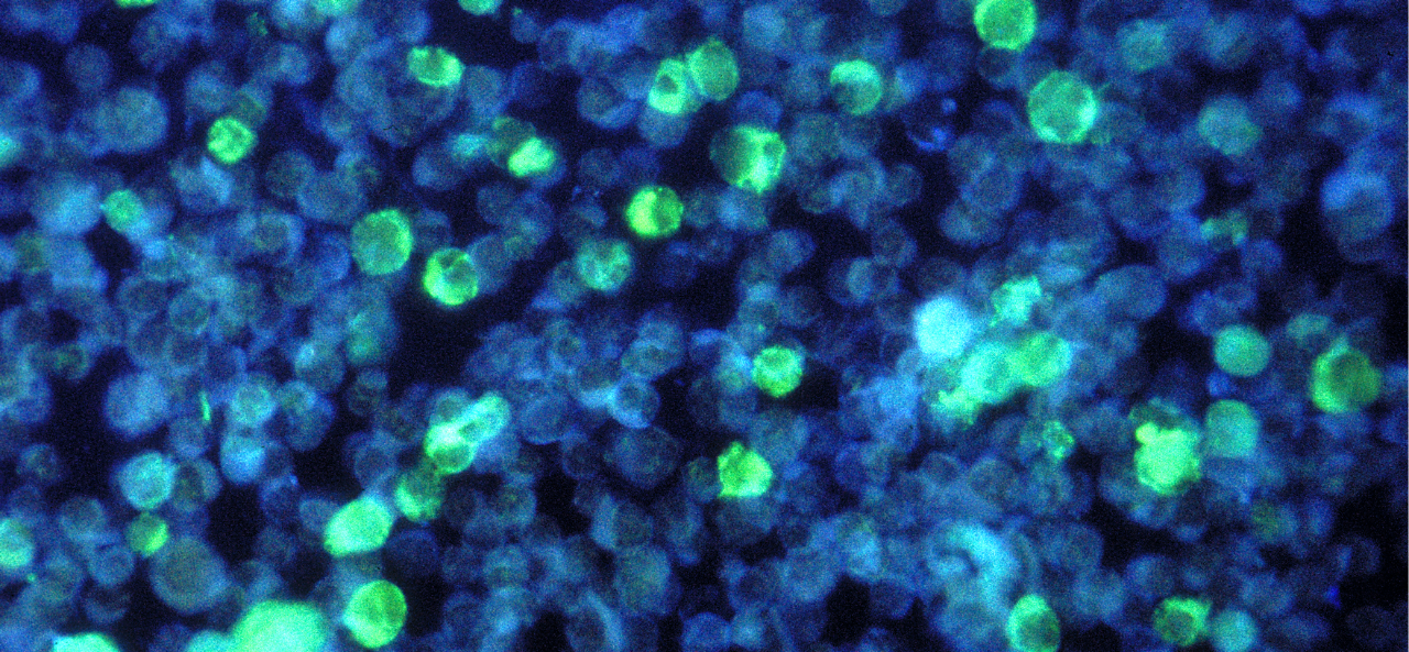 Mikroskopische Aufnahme von Gewusel aus unscharfen Zellen, einige leuchten.