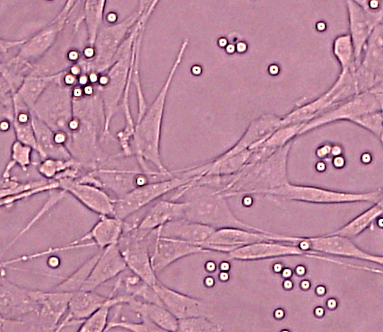 Zellkultur Leukämiezellen: Die gesunde zelluläre Umgebung unterstützt Leukämiezellen
