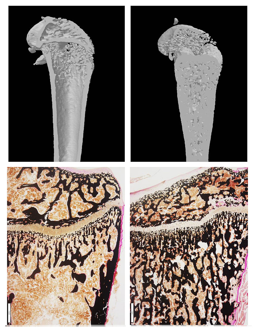Oberschenkelknochen von gesunden und Osteopetrose-Mausmodellen