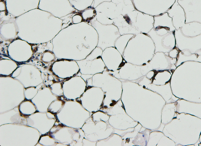 Mikroskopische Aufnahme von vielen Makrophagen, die Fettzellen einkreisen