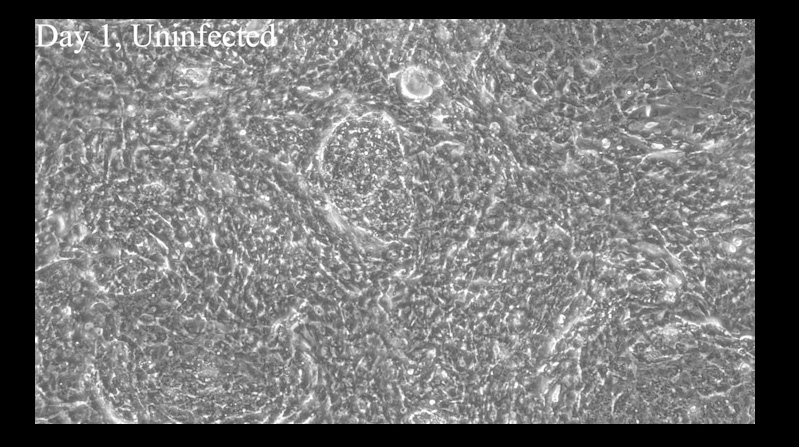 Screenshot Video spontan schlagende Herzmuskelzellen 