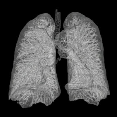 3D illustration of lung 3D illustration of lung