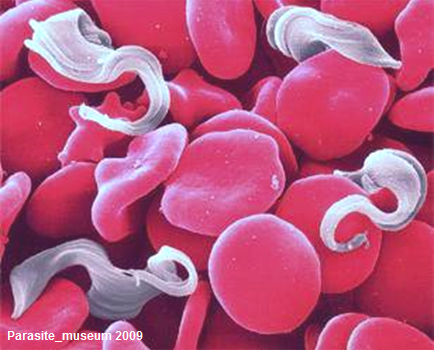 Trypanosomen im Blut eines infizierten Patienten Trypanosomen im Blut eines infizierten Patienten