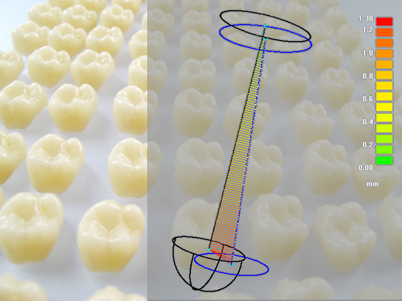 Grafik zum Vortrag Zahnersatz